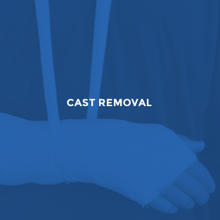 Cast Removal