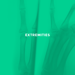 Extremities