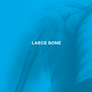 Large Bone