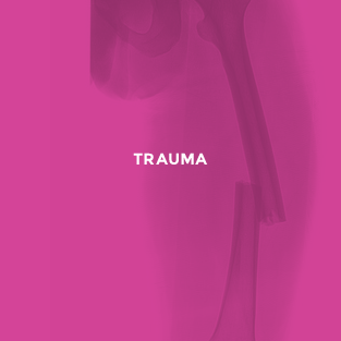 Trauma